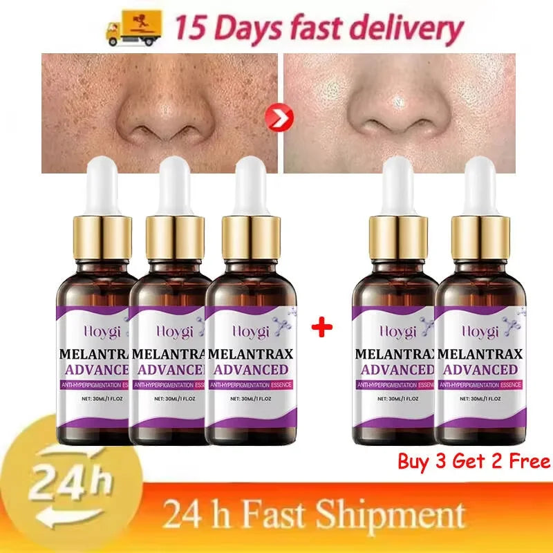 Hoygi – Melantrax Advanced | Essence Anti-Hyperpigmentation & Taches 30ml