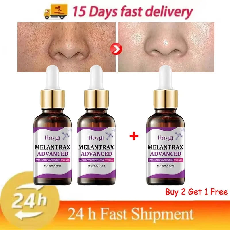 Hoygi – Melantrax Advanced | Essence Anti-Hyperpigmentation & Taches 30ml