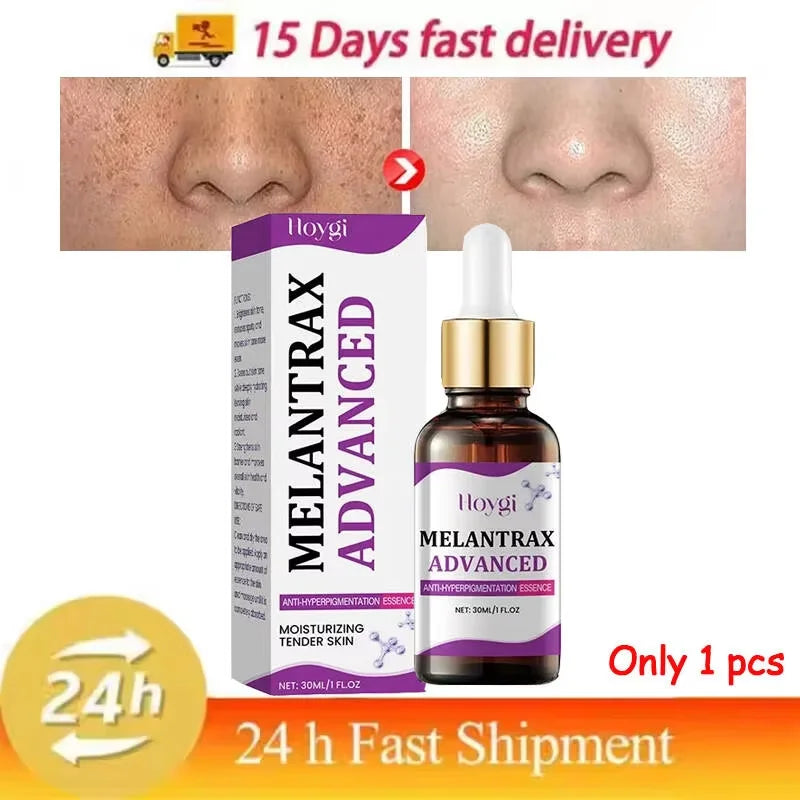 Hoygi – Melantrax Advanced | Essence Anti-Hyperpigmentation & Taches 30ml