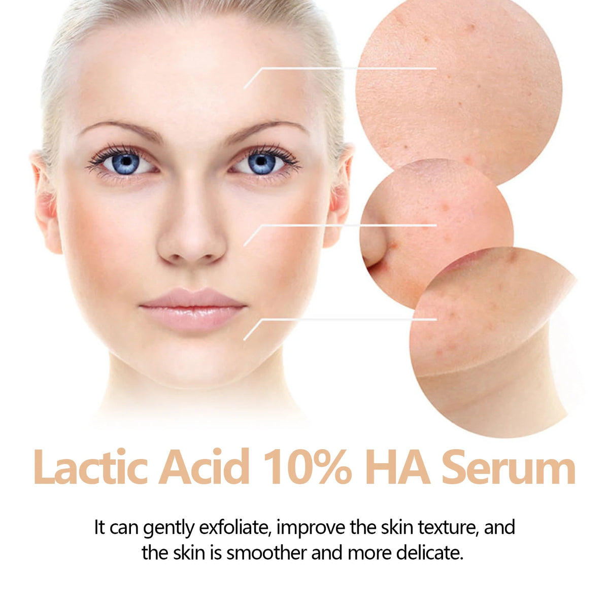 Hoygi – Sérum Lactic Acid 10% + Acide Hyaluronique | Exfoliant & Lissant 30ml